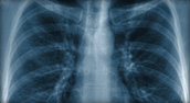 Electronic and Radiological Devices